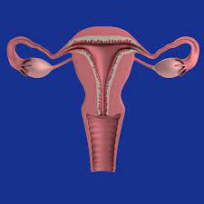 Read more about the article What Is Endometrial Hyperplasia?